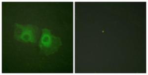 Immunofluorescence analysis of HeLa cells using Anti-Keratin 18 Antibody The right hand panel represents a negative control, where the antibody was pre-incubated with the immunising peptide