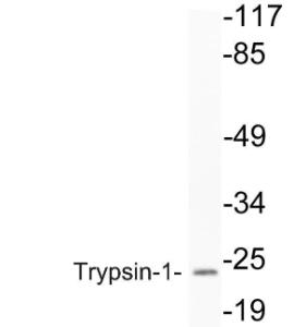 Western blot analysis of lysate from 293 cells using Anti-Trypsin-1 Antibody