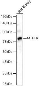 Western blot analysis of Rat kidney, using Anti-MTHFR Antibody (A307982) at 1:2,500 dilution