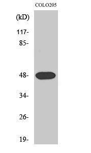 Western blot analysis of various cells using Anti-SYT11 Antibody