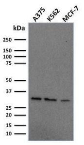 Anti-RPA2 Mouse Monoclonal Antibody [clone: RPA2/2106]