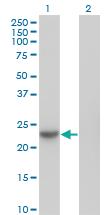 Anti-NME6 Mouse Monoclonal Antibody [clone: 2A10]