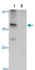 Anti-NKX3-2 Rabbit Polyclonal Antibody