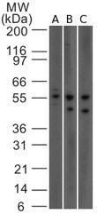 Anti-IL23R Mouse Monoclonal Antibody [clone: 15N6C6]