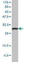 Anti-SFN Mouse Monoclonal Antibody [clone: 3C3]