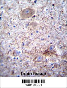 Anti-PCDHA7 Rabbit Polyclonal Antibody (APC (Allophycocyanin))