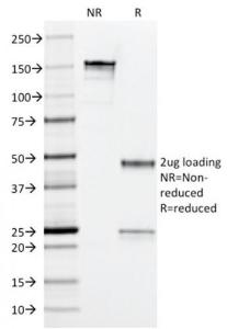 Anti-Arginase 1 Mouse Monoclonal Antibody [clone: ARG1/1126]