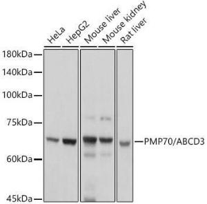 Western blot analysis of extracts of various cell lines, using Anti-PMP70 Antibody (A306728) at 1:1,000 dilution. The secondary antibody was Goat Anti-Rabbit IgG H&L Antibody (HRP) at 1:10,000 dilution.