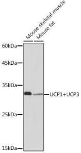 Western blot analysis of extracts of various cell lines, using Anti-UCP1 +UCP3 Antibody [ARC2304] (A307983) at 1:1,000 dilution