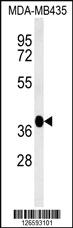 Anti-FBXL14 Rabbit Polyclonal Antibody