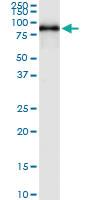 Anti-SPHK2 Polyclonal Antibody Pair