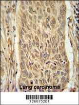 Anti-INMT Rabbit Polyclonal Antibody (HRP (Horseradish Peroxidase))