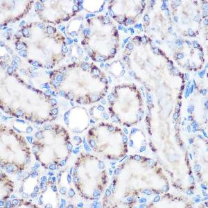 Immunohistochemistry analysis of paraffin-embedded rat kidney using Anti-PMP70 Antibody (A306728) at a dilution of 1:100 (40x lens). Perform microwave antigen retrieval with 10 mM Tris/EDTA buffer pH 9.0 before commencing with IHC staining protocol.