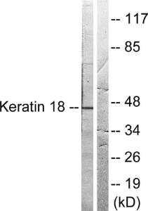 Western blot analysis of lysates from HeLa cells, treated with UV 5' using Anti-Keratin 18 Antibody The right hand lane represents a negative control, where the antibody is blocked by the immunising peptide