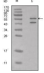 Anti-CALR Rabbit Polyclonal Antibody [clone: 13B95]