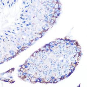 Immunohistochemistry analysis of paraffin-embedded mouse testis using Anti-PMP70 Antibody (A306728) at a dilution of 1:100 (40x lens). Perform microwave antigen retrieval with 10 mM Tris/EDTA buffer pH 9.0 before commencing with IHC staining protocol.