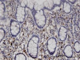 Anti-NME6 Mouse Monoclonal Antibody [clone: 2A10]