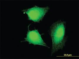 Anti-CCDC83 Mouse Monoclonal Antibody [clone: 3E3]