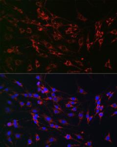 Immunofluorescence analysis of C6 cells using Anti-PMP70 Antibody (A306728) at a dilution of 1:100 (40x lens). DAPI was used to stain the cell nuclei (blue).