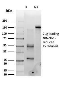 SDS-PAGE analysis of Anti-PMS1 Antibody [PCRP-PMS1-2E11] under non-reduced and reduced conditions; showing intact IgG and intact heavy and light chains, respectively SDS-PAGE analysis confirms the integrity and purity of the antibody