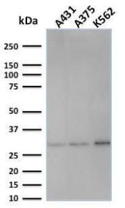 Western blot analysis of human A431, A375, and K562 cell lysates using Anti-RPA2 Antibody [SPM316]