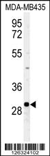 Anti-FBXL15 Rabbit Polyclonal Antibody