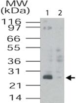 Anti-TMED4 Rabbit Polyclonal Antibody