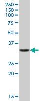 Anti-SULT1E1 Mouse Polyclonal Antibody