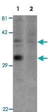 Anti-OGFOD2 Rabbit Polyclonal Antibody