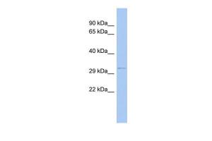 Anti-ODF4 Rabbit Polyclonal Antibody