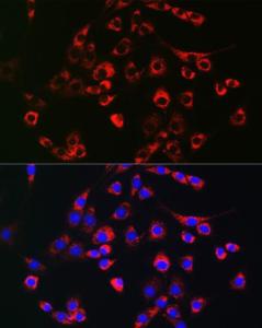 Immunofluorescence analysis of NIH-3T3 cells using Anti-PMP70 Antibody (A306728) at a dilution of 1:100 (40x lens). DAPI was used to stain the cell nuclei (blue).