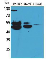 Western blot analysis of SW480, SKOV3, HepG2 cells using Anti-CFLAR Antibody