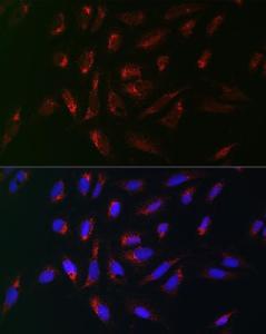 Immunofluorescence analysis of U-2 OS cells using Anti-PMP70 Antibody (A306728) at a dilution of 1:100 (40x lens). DAPI was used to stain the cell nuclei (blue).