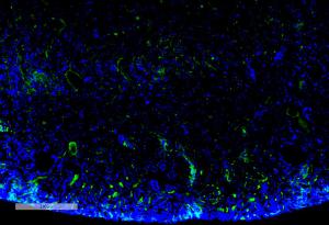 Immunohistochemistry analysis of mouse kidney