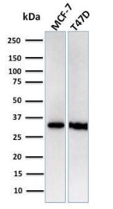 Western blot analysis of human MCF-7 and T47D cell lysates using Anti-RPA2 Antibody [RPA2/3140R]