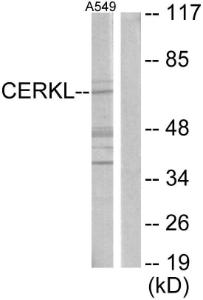 Western blot analysis of lysates from A549 cells using Anti-CERKL Antibody. The right hand lane represents a negative control, where the antibody is blocked by the immunising peptide