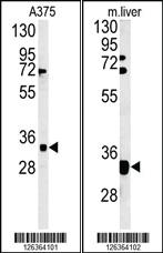 Anti-FYTD1 Rabbit Polyclonal Antibody