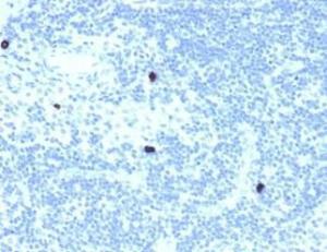 Immunohistochemical analysis of formalin-fixed, paraffin-embedded human lymph node using Anti-RXRB Antibody [PCRP-RXRB-2B6]