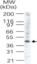 Anti-TRIB3 Rabbit Polyclonal Antibody