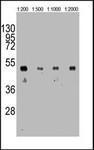 Anti-HA tag Mouse Monoclonal Antibody [clone: 12CA5]