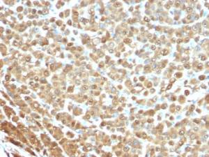 Anti-S100A1 Mouse Monoclonal Antibody [clone: S1/61]