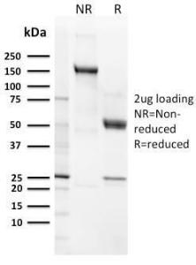 Antibody anti-CD21 CR23124R 100 µg