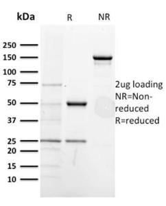 SDS-PAGE analysis of Anti-CD5 Antibody [CD5/2418] under non-reduced and reduced conditions; showing intact IgG and intact heavy and light chains, respectively. SDS-PAGE analysis confirms the integrity and purity of the Antibody