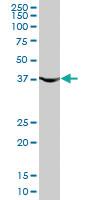 Anti-PGK1 Mouse Monoclonal Antibody [clone: 2H4]