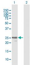 Anti-MPZL2 Mouse Polyclonal Antibody