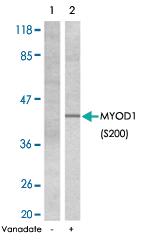 Anti-MYOD Rabbit Polyclonal Antibody