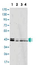 Anti-MAPK1 Mouse Monoclonal Antibody [clone: 3F8]