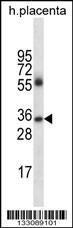 Anti-IGHG4 Rabbit Polyclonal Antibody (AP (Alkaline Phosphatase))