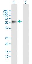 Anti-ARSA Rabbit Polyclonal Antibody