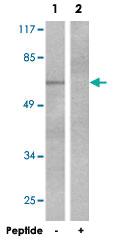 Anti-CTTN Rabbit Polyclonal Antibody